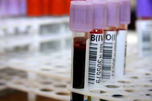 кровь анализ донор