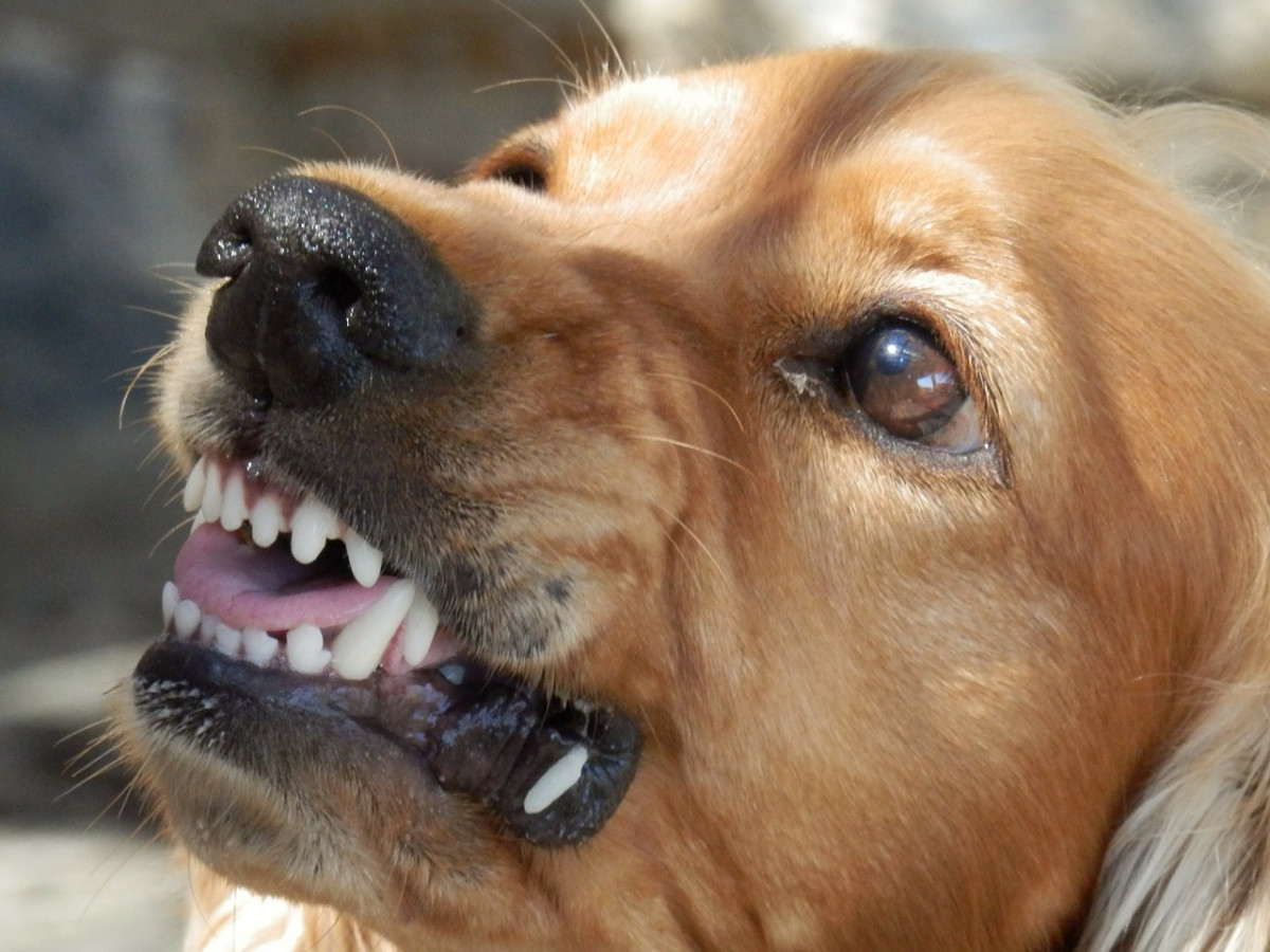 Сорвавшаяся с цепи собака покусала десятилетнего мальчика в Шахунье