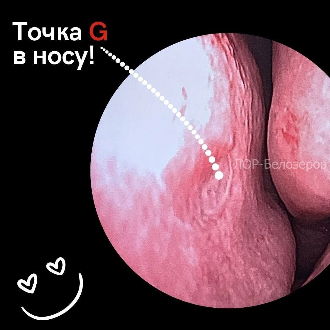 Нижегородский ЛОР-хирург показал, где находится точка G в носу