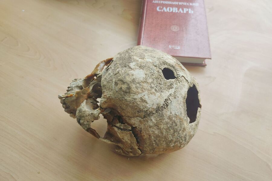 В Городце археологи обнаружили череп с трепанацией